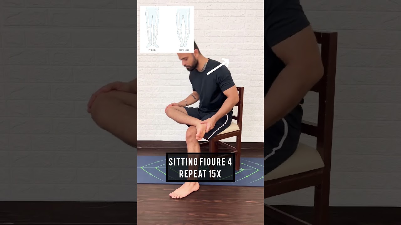 Bow Legs Exercises