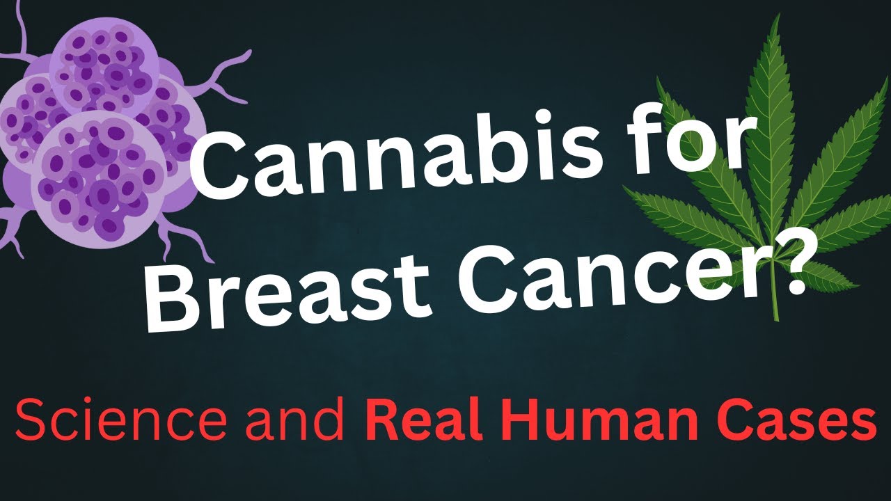 How Cannabinoids May Help Treat Breast Cancer | Research and Human Cases | Cannabis For Cancer