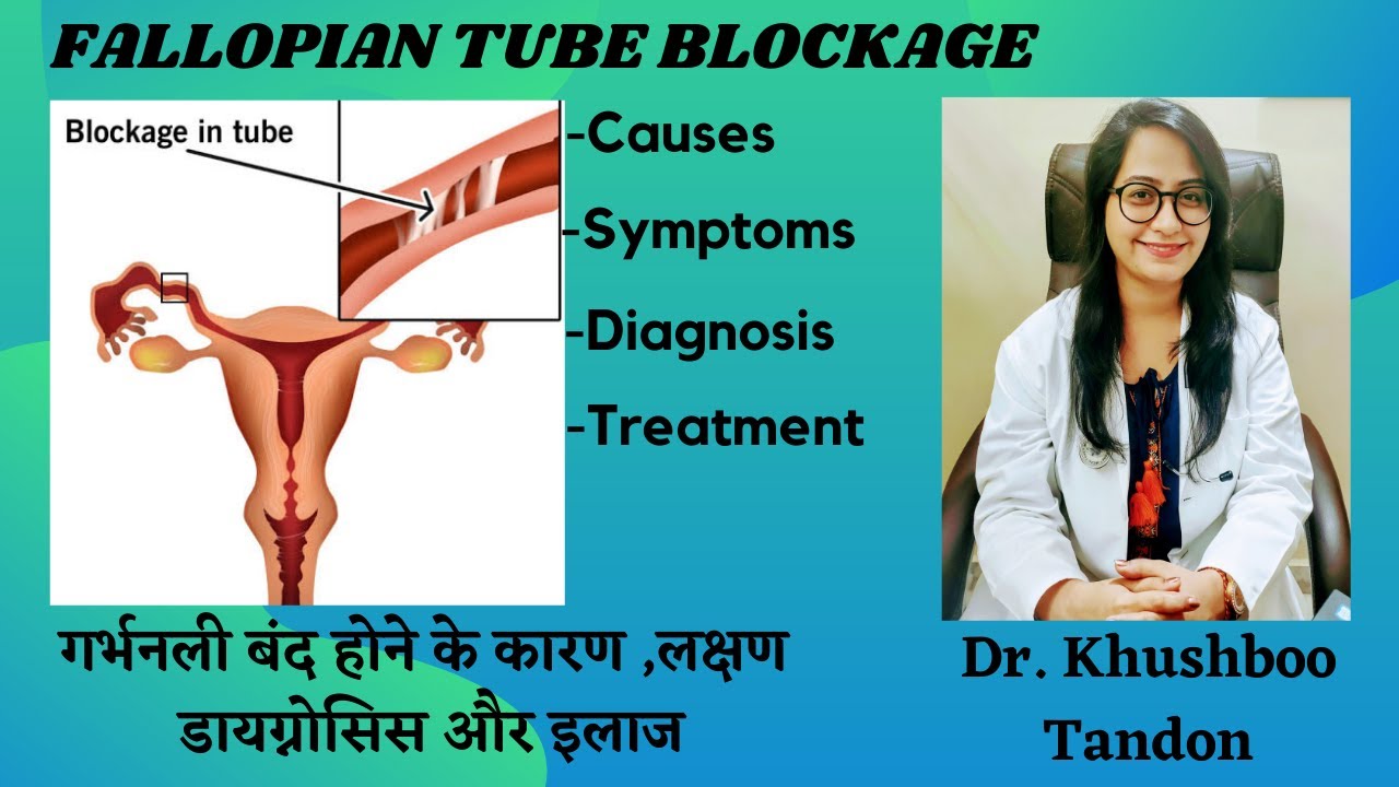 Fallopian Tube Blockage Symptoms, Causes and Treatment | बंद फैलोपियन ट्यूब के लक्षण, कारण और इलाज।