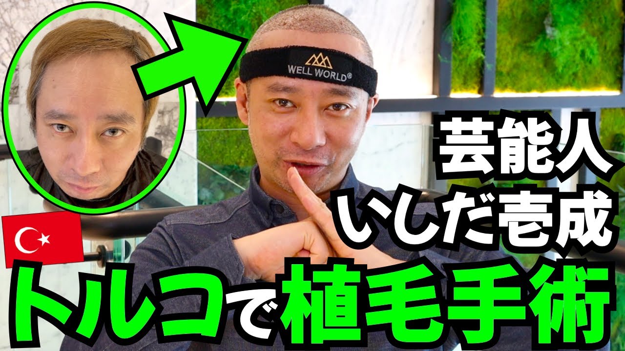 【芸能人】いしだ壱成さんとトルコ植毛手術の旅【植毛大使｜治療｜薄毛の窓口】