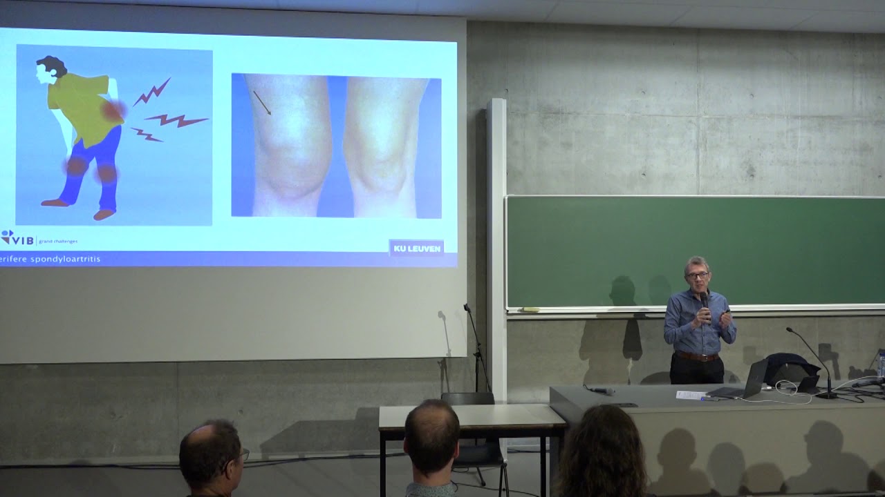 Een vroege interventie voor spondyloartritis