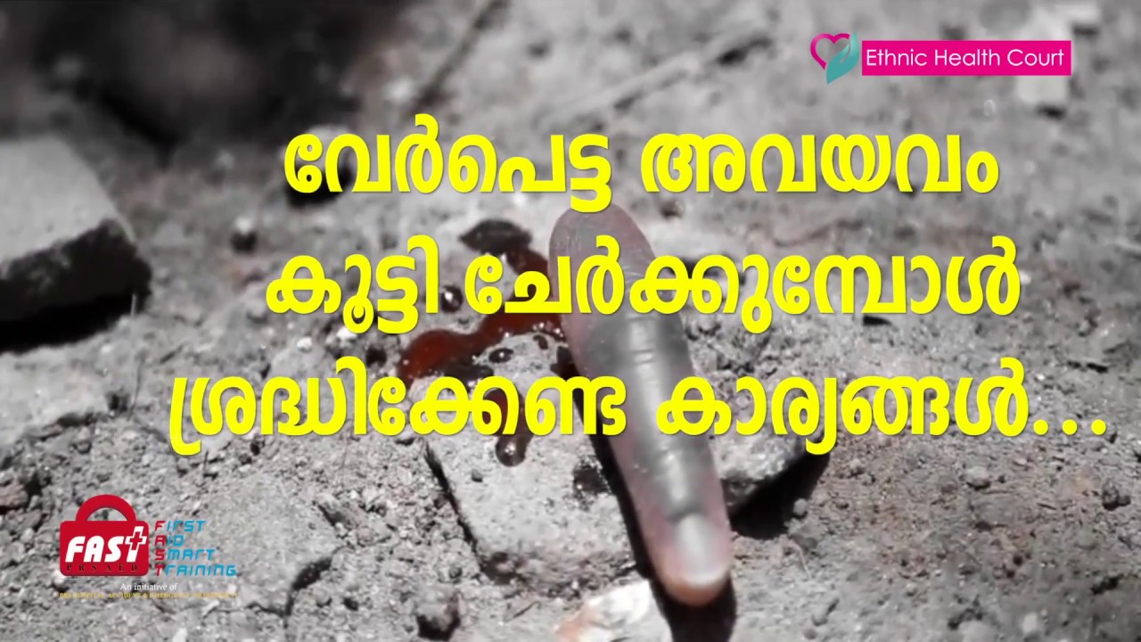 Severe cuts on legs or hands | കൈയ്യൊ കാലോ മുറിഞ്ഞുപോയാൽ