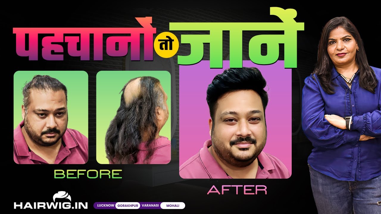 Men Hair Patch |#transformation  #gorakhpur #PinkiSingh #Hairwig #lucknow #trending #viral #hairwig