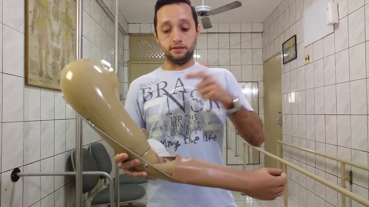 Prótese para Amputação do Braço - acima do cotovelo nível TRANSUMERAL #amputação #protese