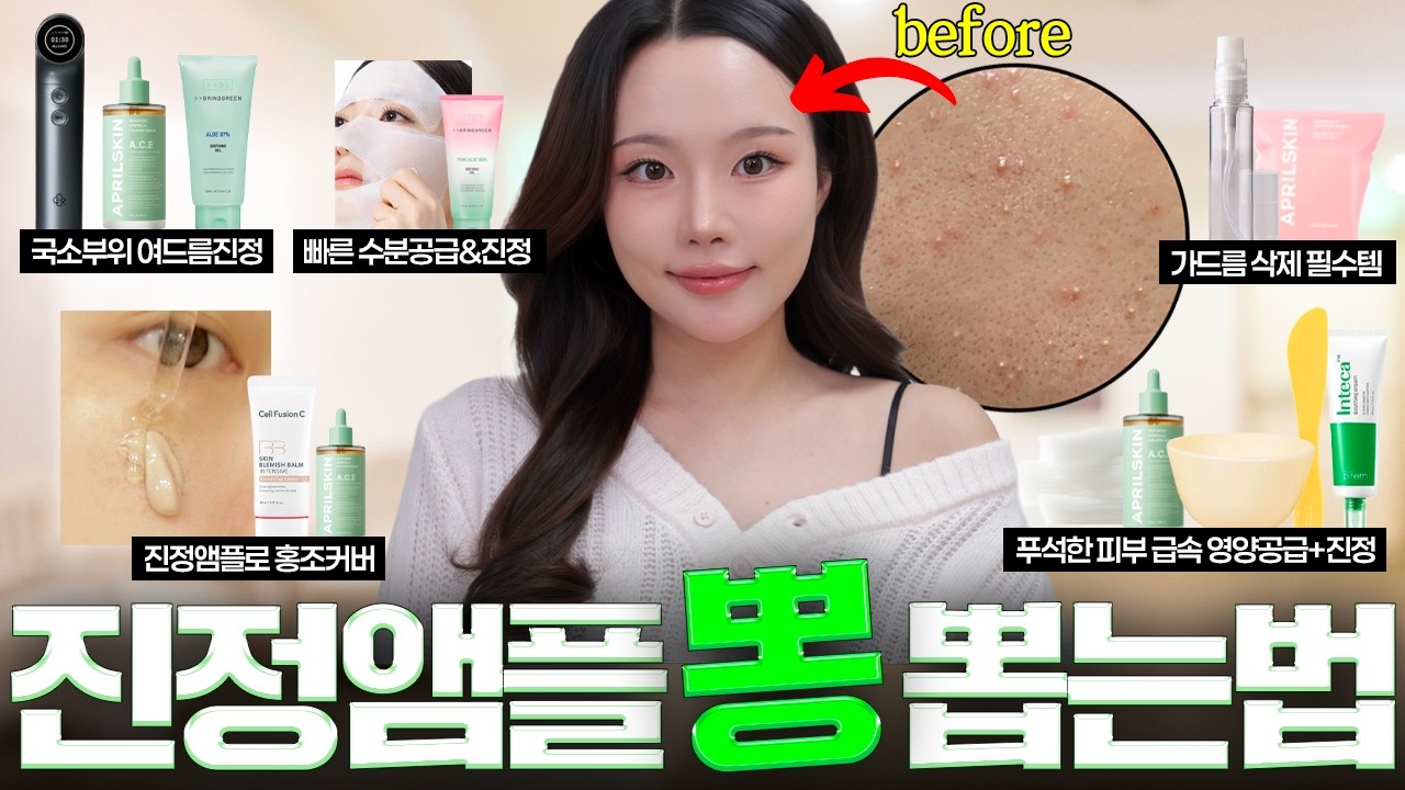진정앰플 있다면 이대로만 따라하세요.. 피부 신세계 열립니다‼️급속 여드름진정 | 영양공급 진정팩 | 가드름 삭제루틴 | 홍조커버 하는 법