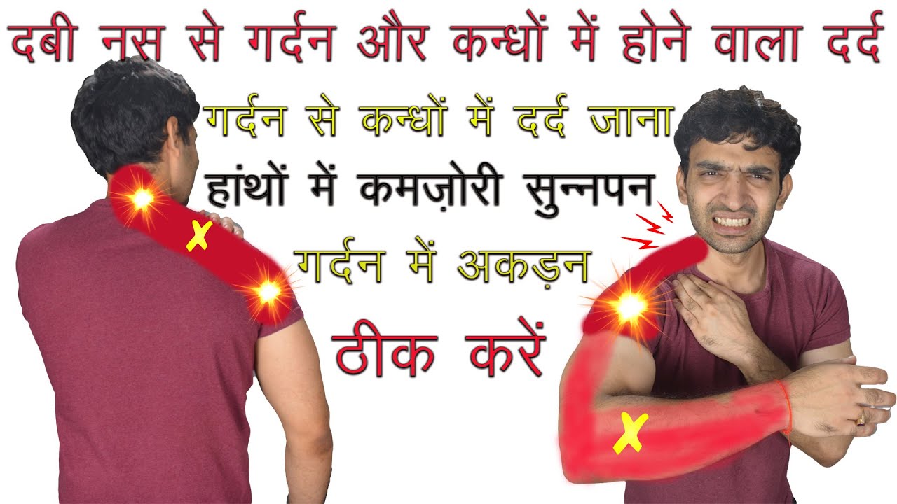 दबी नस से गर्दन से कंधे तक तेज़ दर्द, हांथों में सुन्नपन ठीक करें Fix Pinched Nerve Neck & Shoulder
