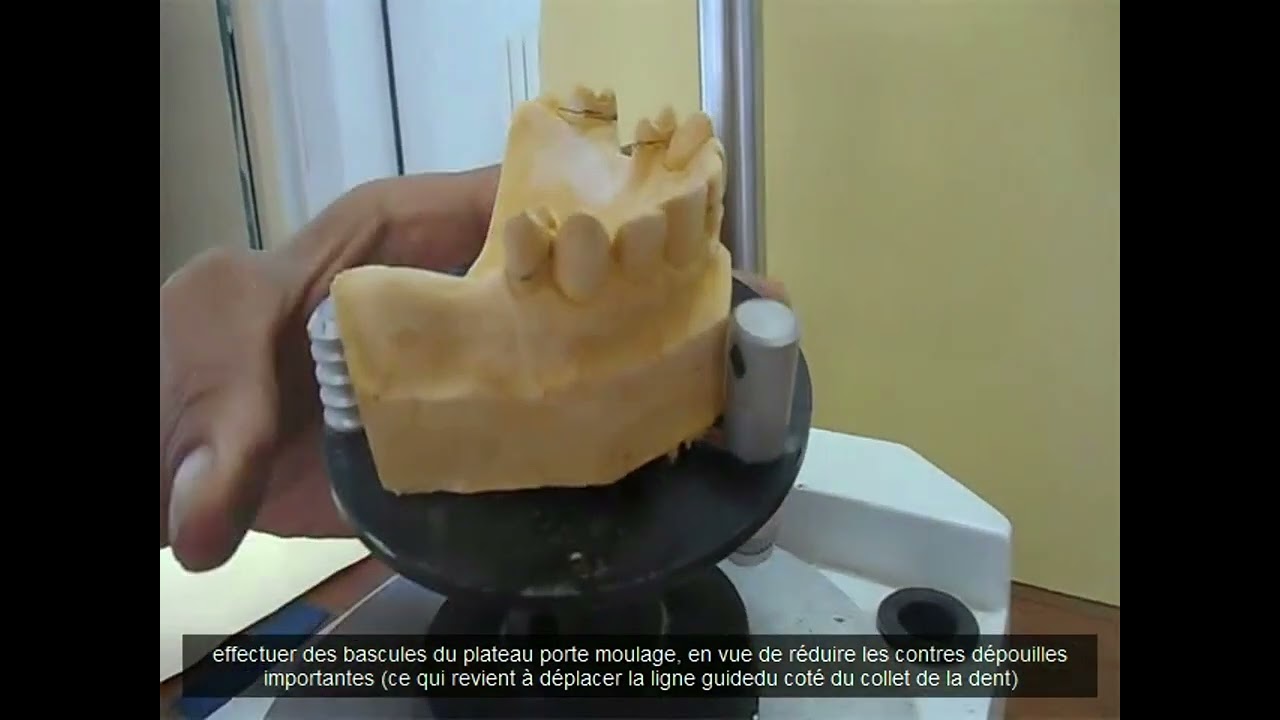 Capsule Vidéo Pédagogique : Démonstration pratique de l'analyse au paralléliseur