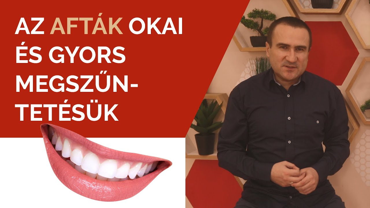 Az Afták okai és gyors megszűntetésük