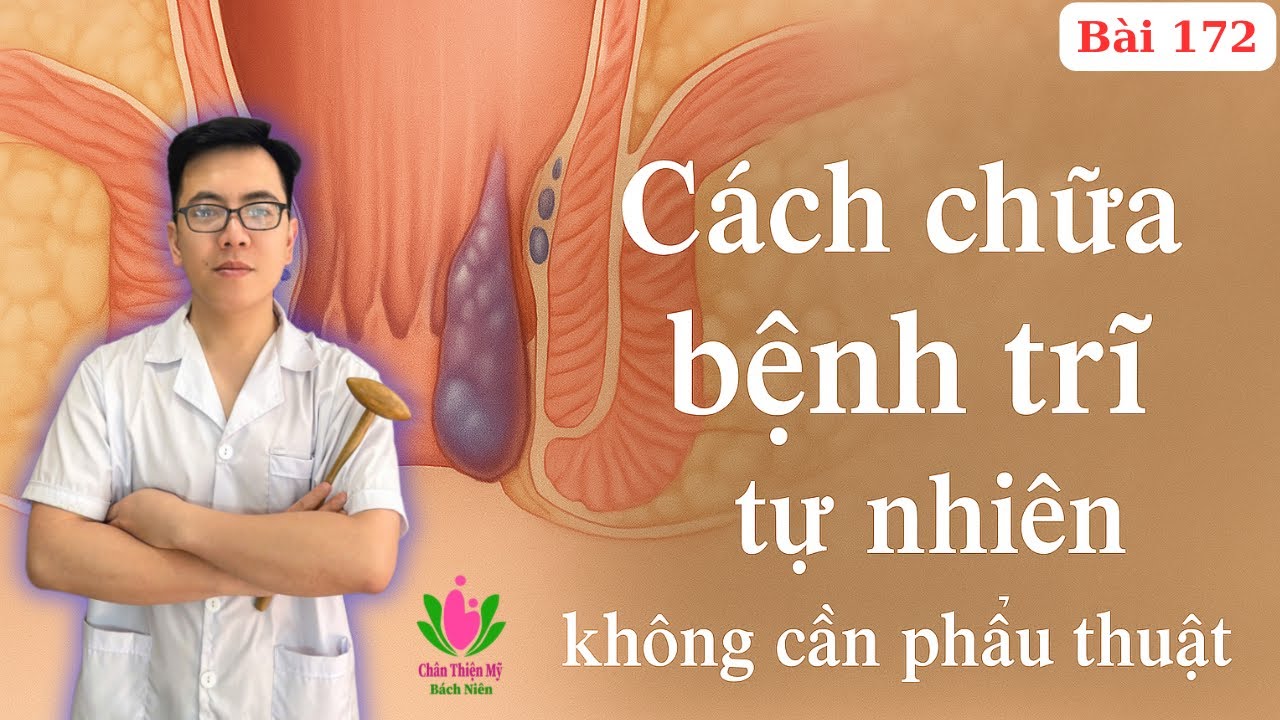Bệnh Trĩ Có Nguy Hiểm Không? Có Nên Cắt Không? Cách Chữa Bệnh Trĩ Tận Gốc Tại Nhà Không Tái Phát