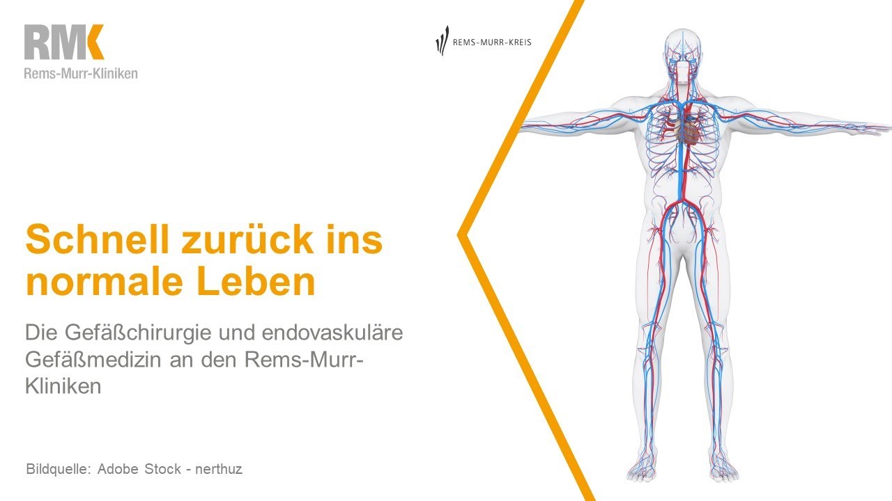 Hochmoderne Gefäßchirurgie und endovaskuläre Gefäßmedizin | Rems-Murr-Kliniken