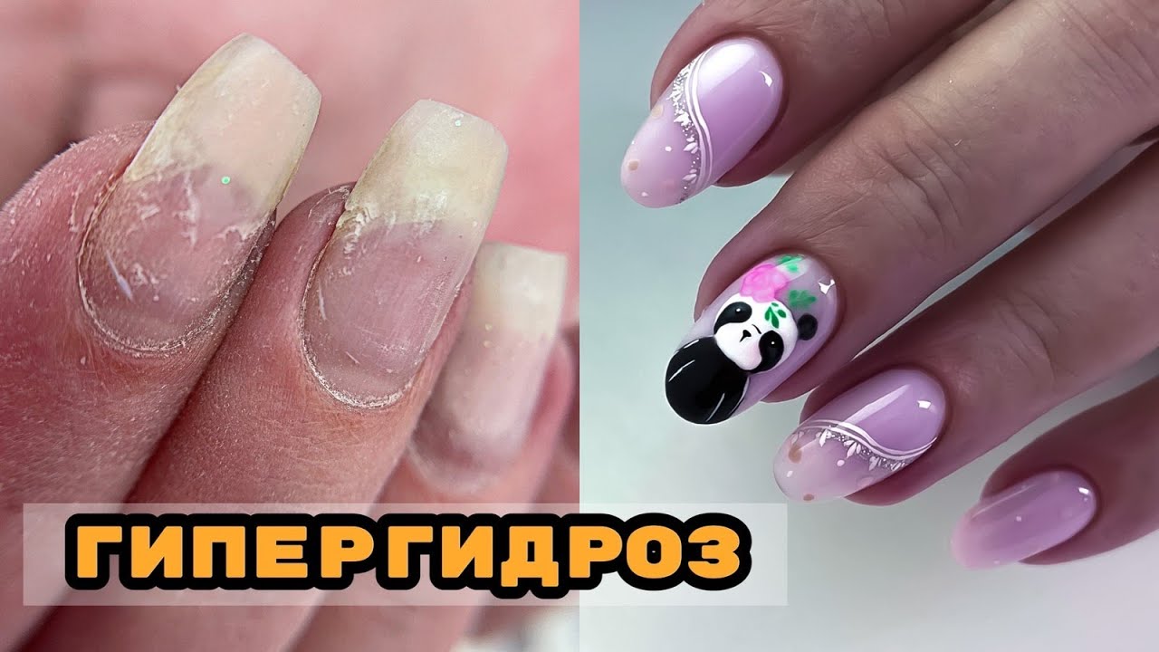 ГИПЕРГИДРОЗ 🥺 Как с этим работать? 💅 Маникюр с весенними гелями Si