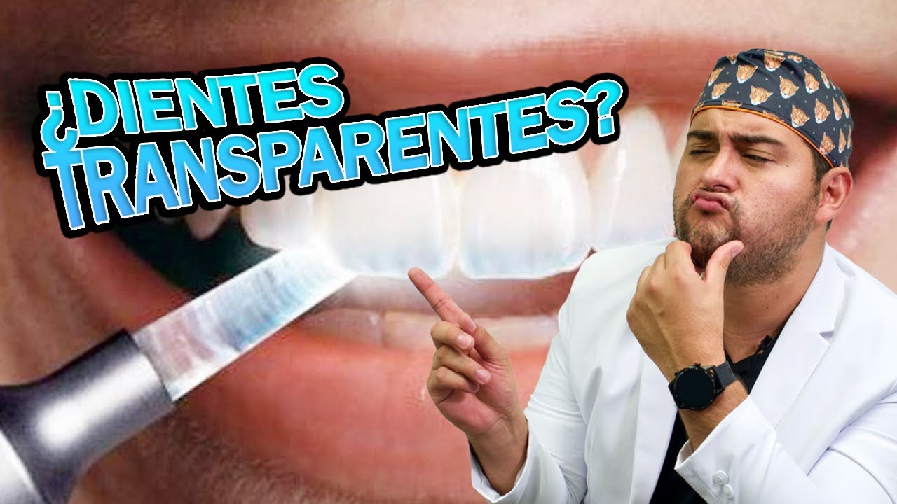 ¿DIENTES TRANSPARENTES? ¿Es NORMAL? ¿Tengo ALGO MALO? Deberías ver este video ❤️😅😊👋🏻