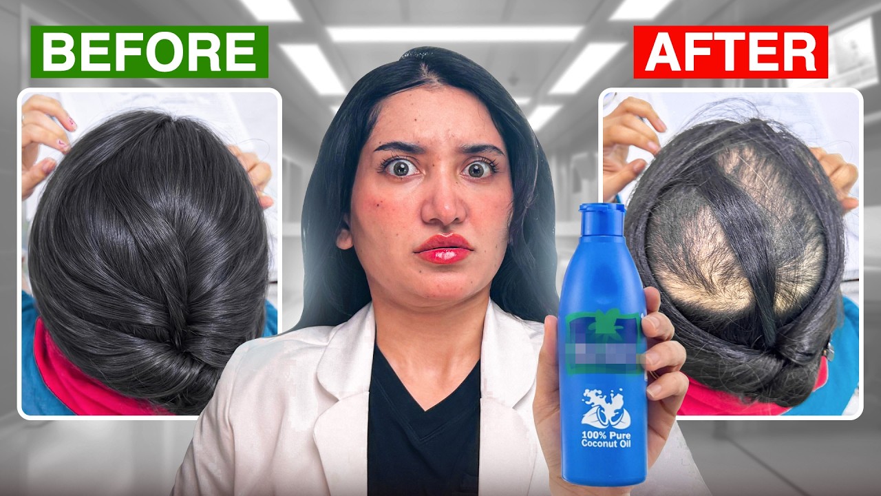 This One Mistake Caused Permanent Hair Loss !