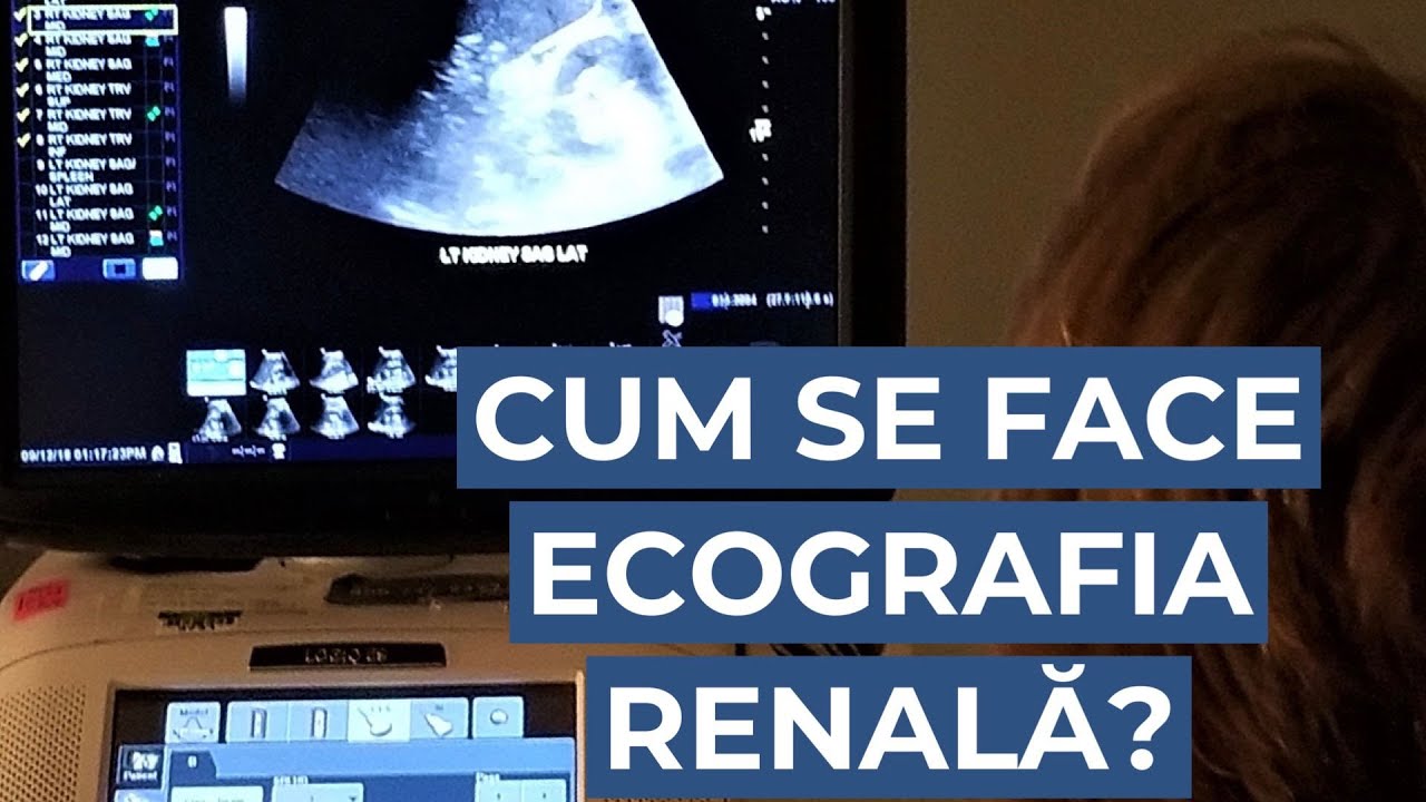 Ecografia renală: ce este, cum funcționează și când se recomandă?