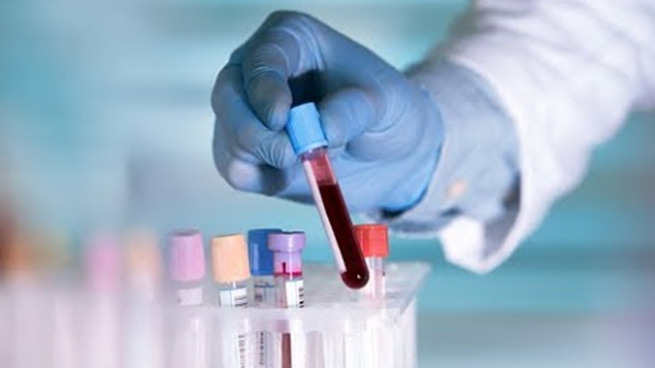 ¿Qué es la anemia?