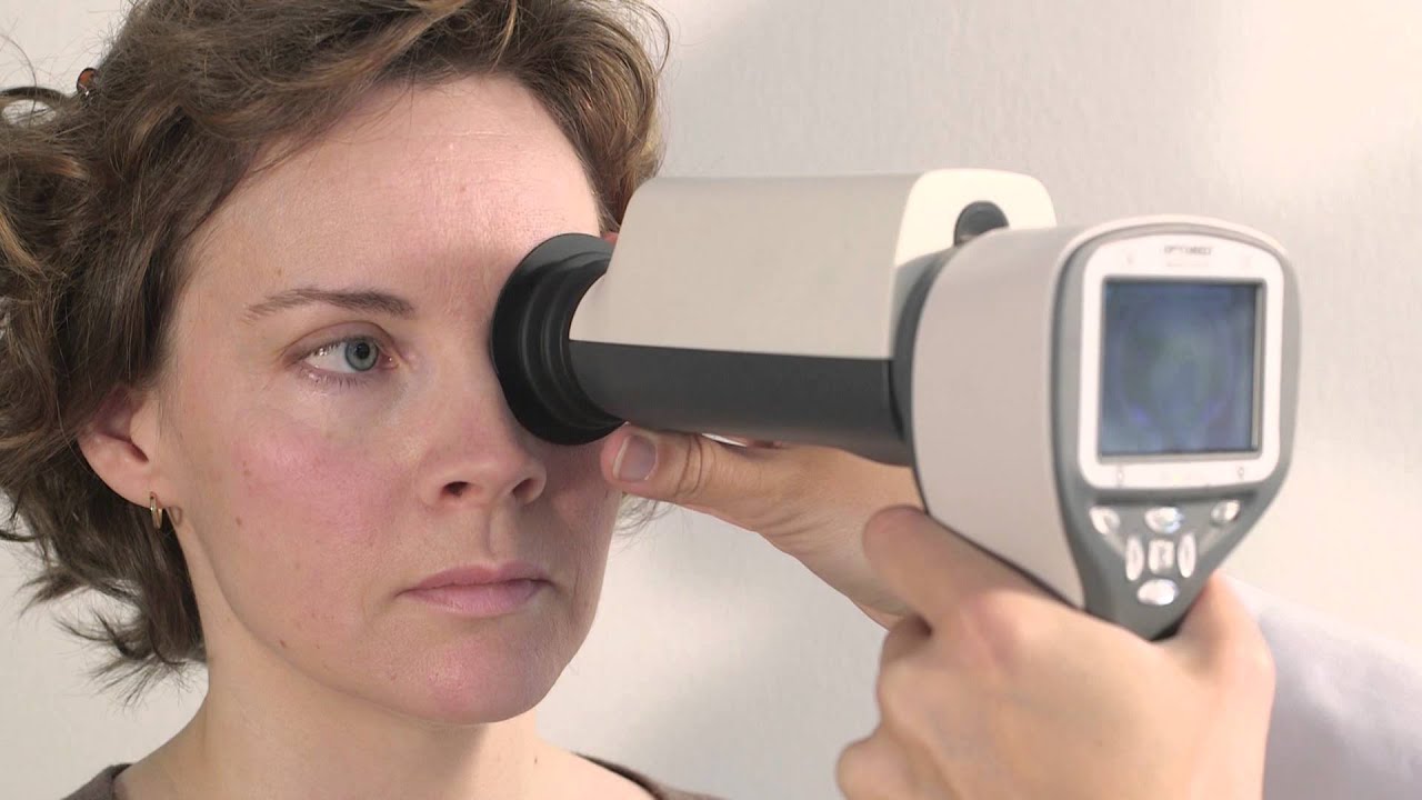 Optomed Smartscope PRO Fundus Imaging
