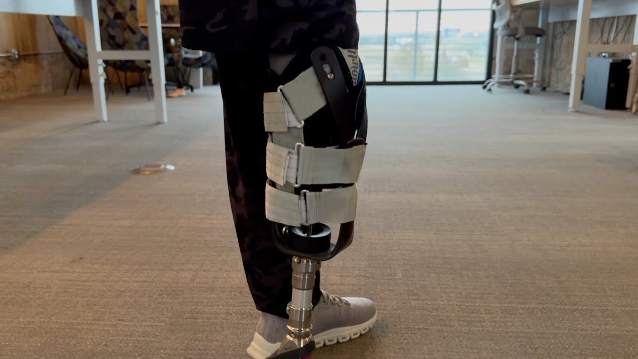 Slingshot Socket Testimonial - BK User | Slingshot Bionics