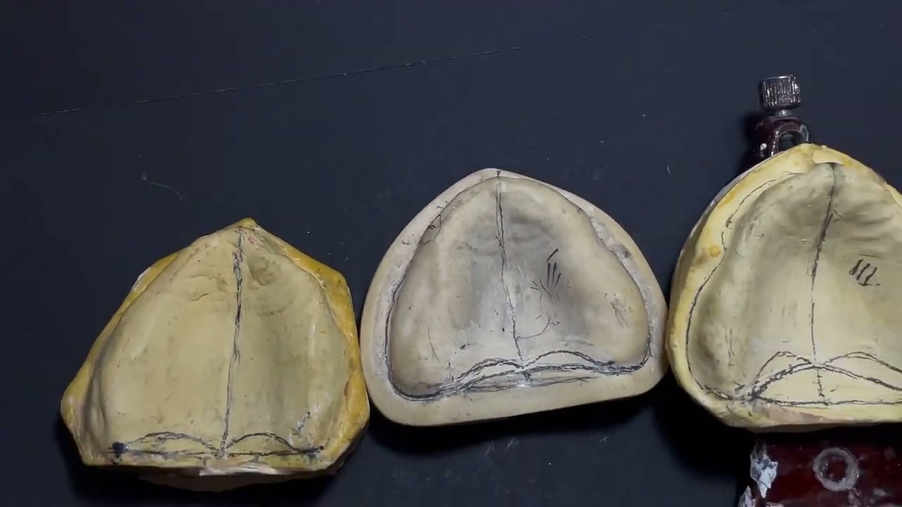Clasificación de paladares y sellado posterior