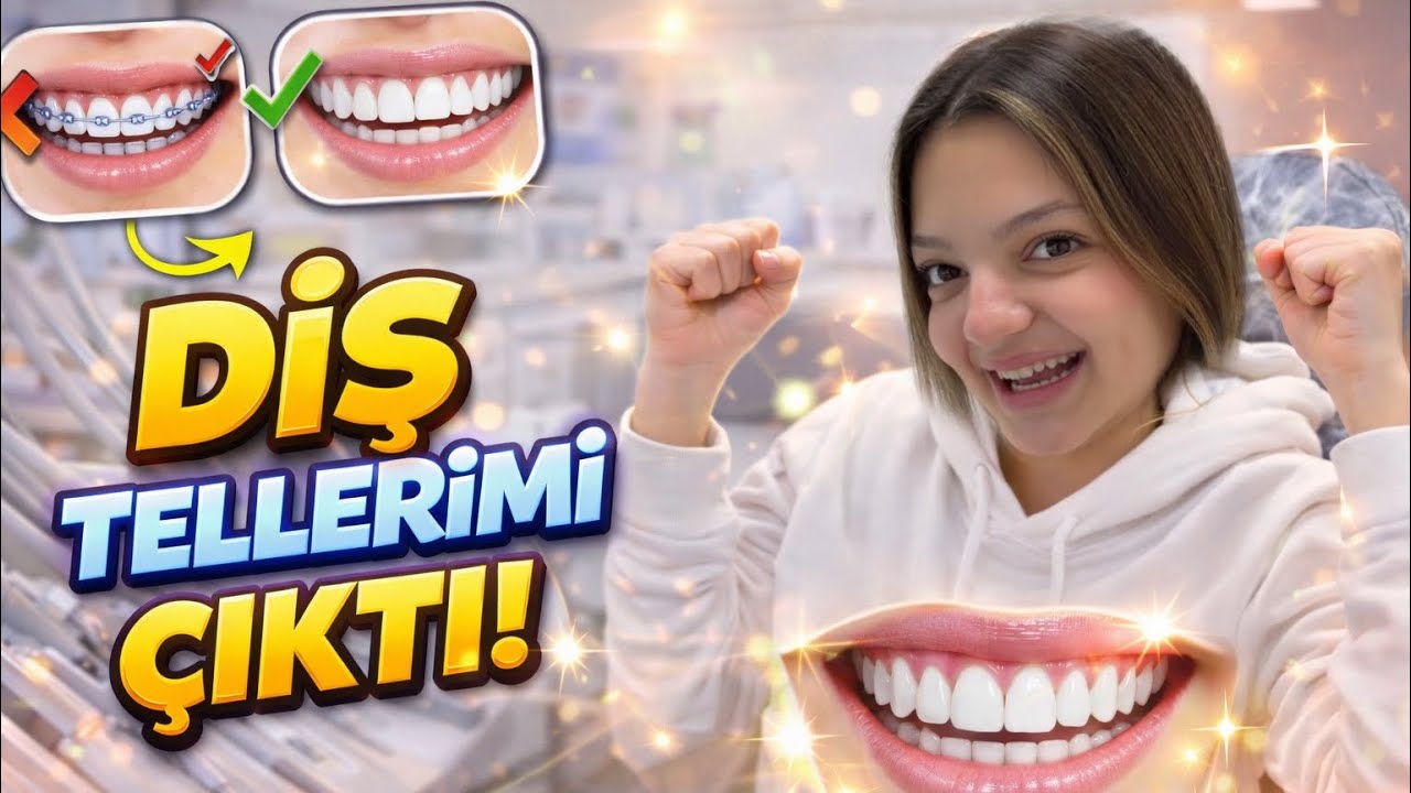 MASAL DİŞ TELLERİNİ ÇIKARTTI / Bizimle Birgün Vlog
