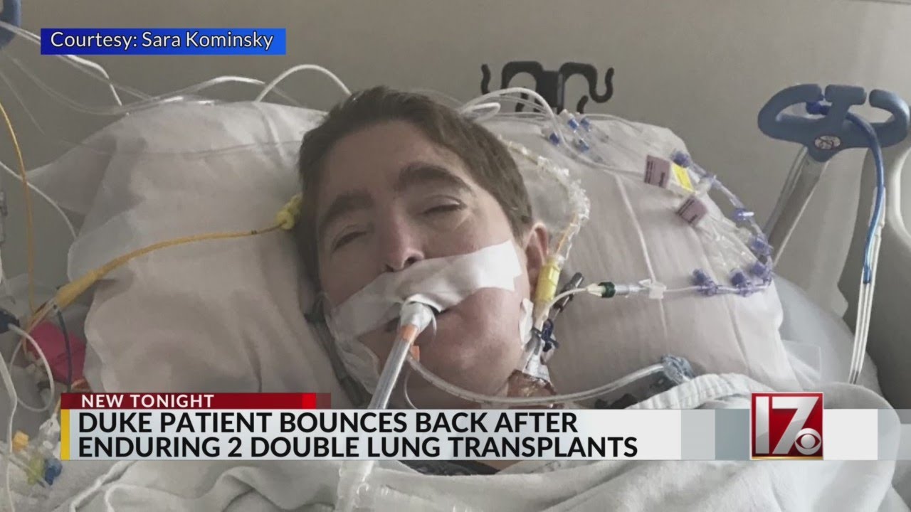 Woman reflects on 2nd double lung transplant, as Duke marks 10,000th organ transplant