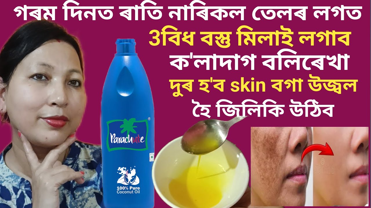 গৰম দিনত ৰাতি নাৰিকল তেলৰ লগত 3বিধ বস্তু মিলাই লগাব skinৰ ক'লাদাগ বলিৰেখা দুৰ হ'বskin Glowহব | vlog