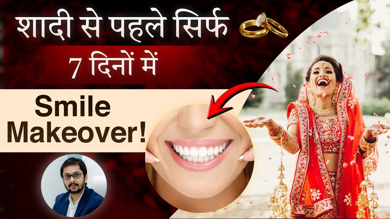 Wedding Ke 7 Din Pehle Smile Makeover Ka Full Plan | Teeth Whitening, Cleaning, Grooming Tips