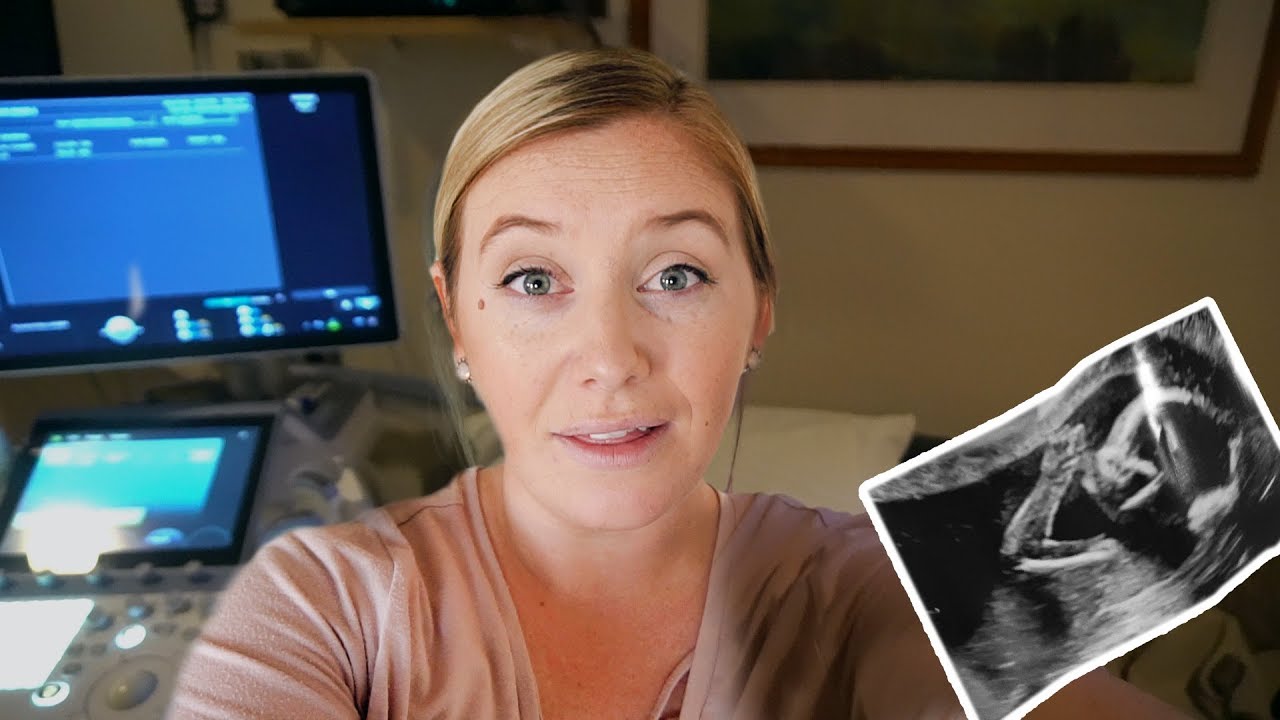 Our BIG Appointment!  Maternal Fetal Medicine Specialist | 21 Weeks Pregnant