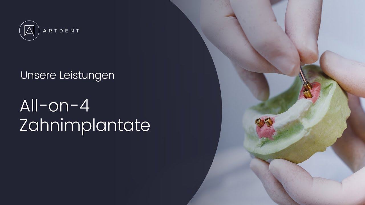 Unsere Leistungen: All-on-4 Zahnimplantate - Artdent Zahnklinik