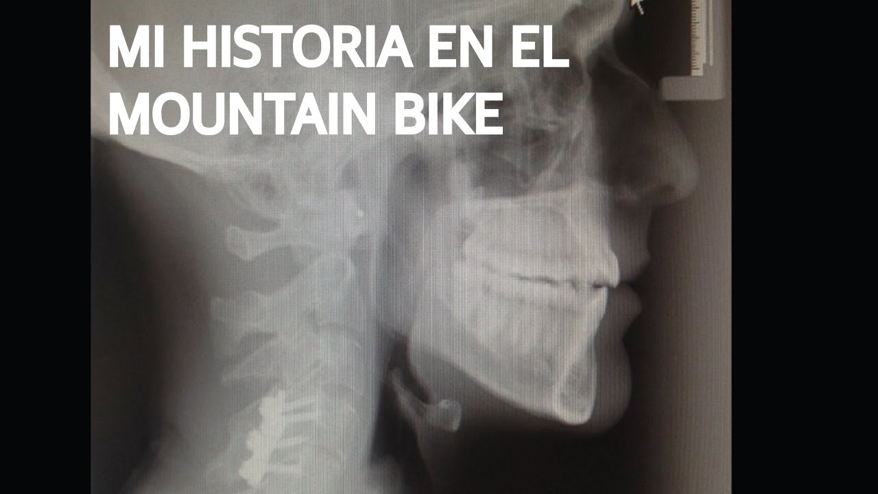 Mi historia en el Mountain Bike! Accidentes en Bicicleta, Moralejas y Consejos!