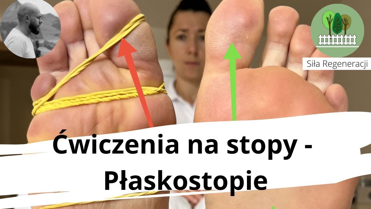 Ćwiczenia na płaskostopie - zdrowe stopy