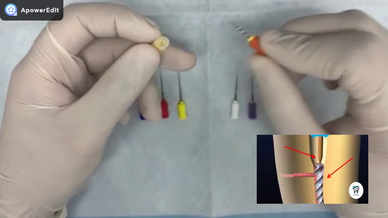 PREPARO BIOMECANICO-PROTAPER