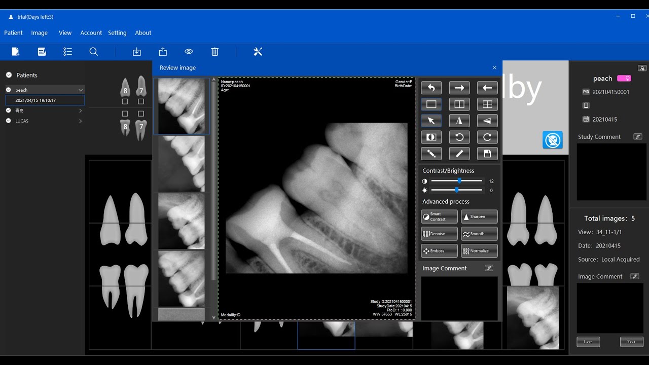 How to use XlinearVision Sensor