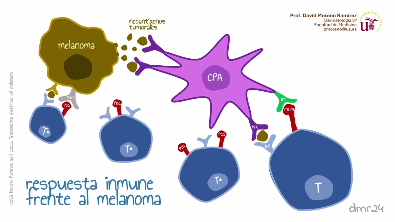 Tema 28 anexo. Inmunoterapia del melanoma
