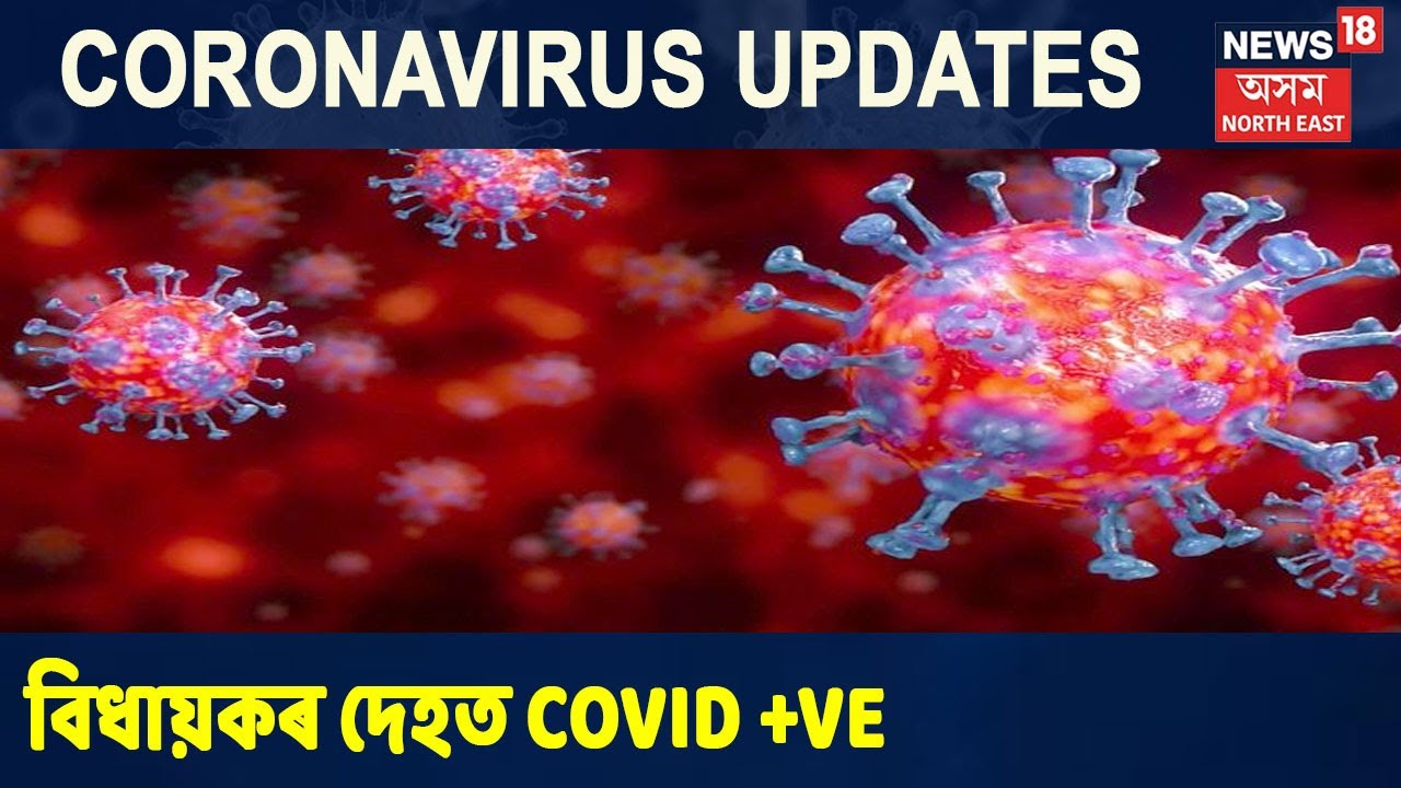 Karimganjৰ বিধায়কৰ দেহত ধৰা পৰিছে COVID-19 মহামাৰী