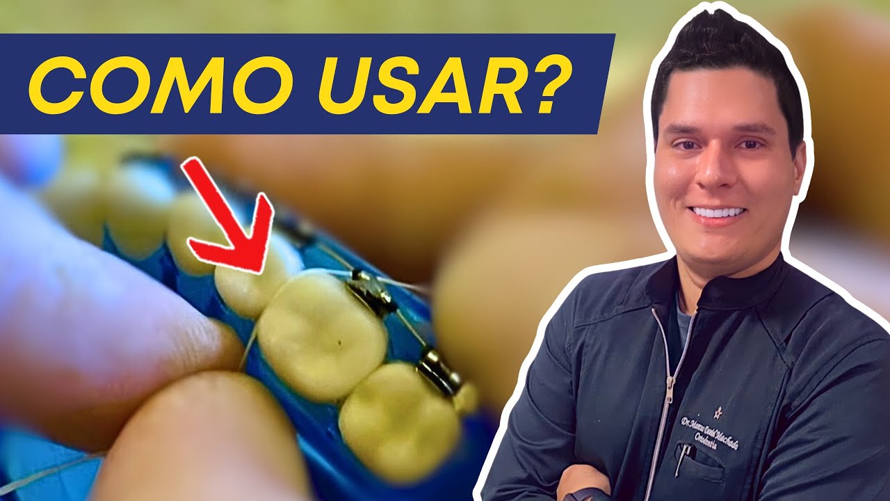 FIO DENTAL para APARELHO Ortodôntico : Como usar do jeito certo?