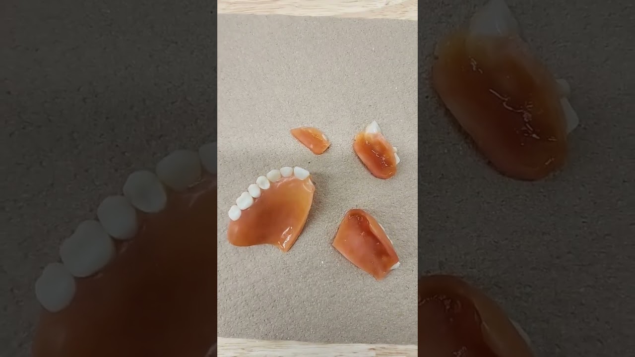 insane denture repair 🤯🤯🤪🫣 #dentallab #denturist #repair #dentalclinic #denture #shorts #steustache