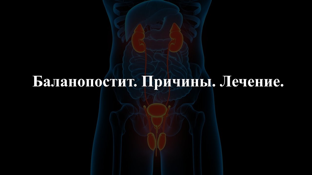 Баланопостит. Причины. Лечение.