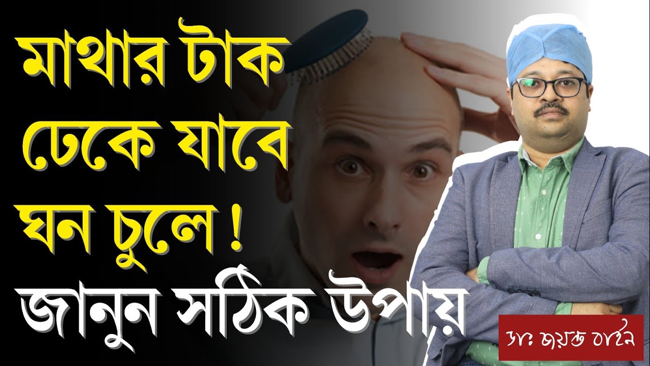 টাক মাথায় চুল গজানোর উপায় | হেয়ার ট্রান্সপ্লান্ট করতে কত টাকা লাগে? | Hair Transplant