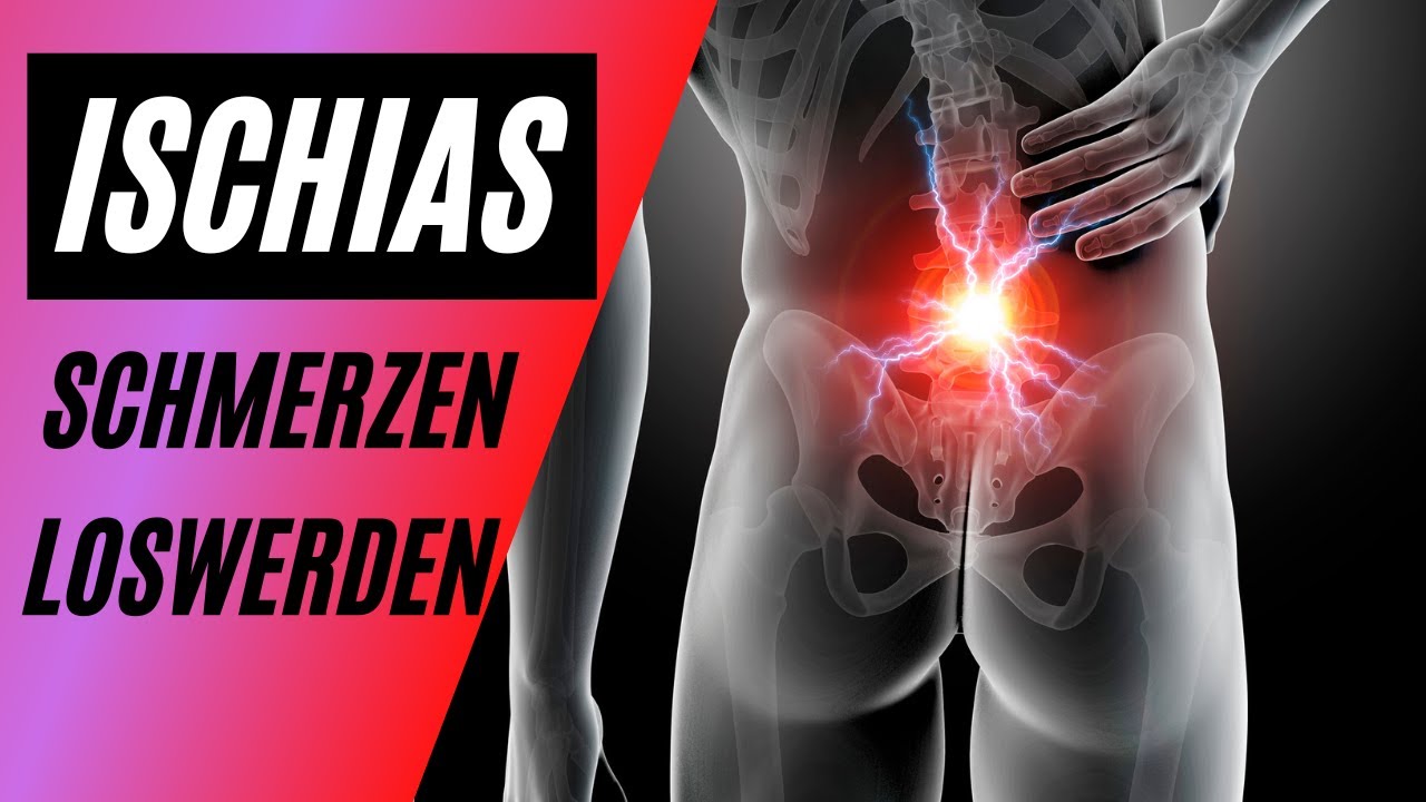Ischiasschmerzen - Was kann man dagegen tun?