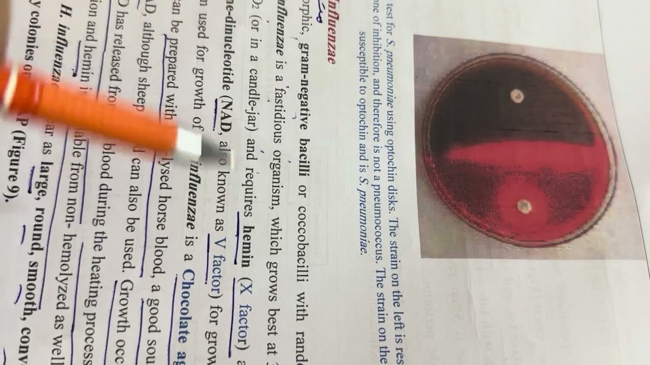 محاضرة البكتريا التشخيصية (١٠/١١)الفديو الثاني مرحلة رابعة وزاري ٢٠٢٦ /الاستاذ مسلم عقيل 