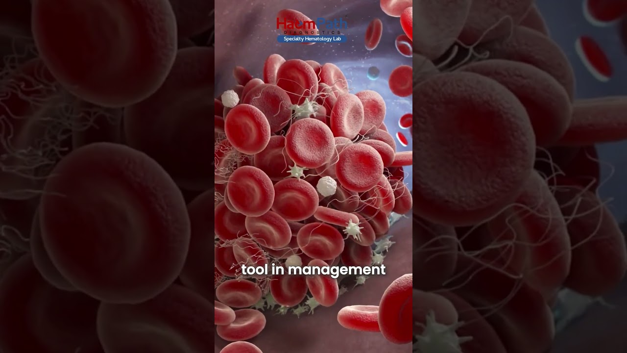 Thrombin Generation Assay (TGA) Explained | Advanced Coagulation Testing by Haempath Diagnostics
