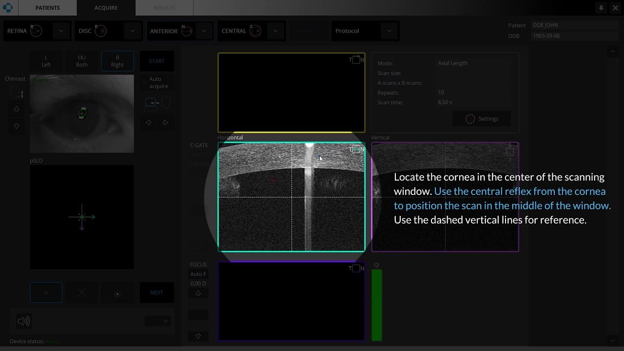 06 Biometry OCT Axial Lenght Manual Mode