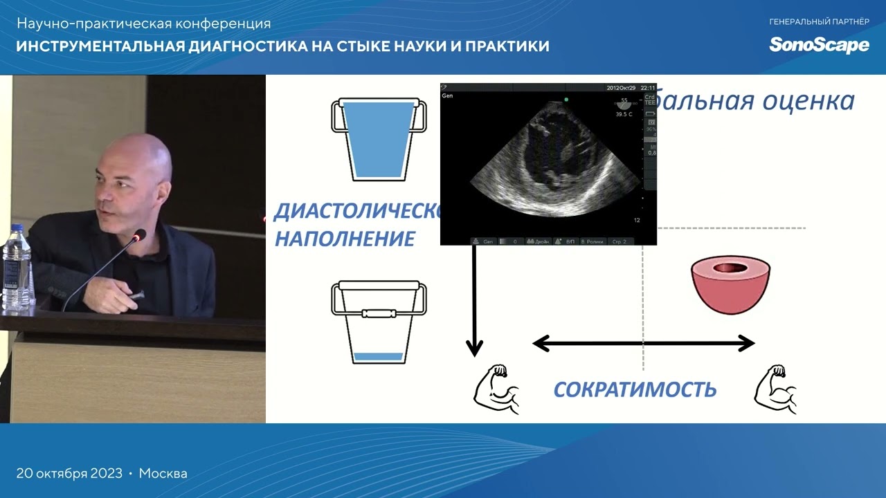 Периоперационный эхокардиографический мониторинг. Кричевский Л.А