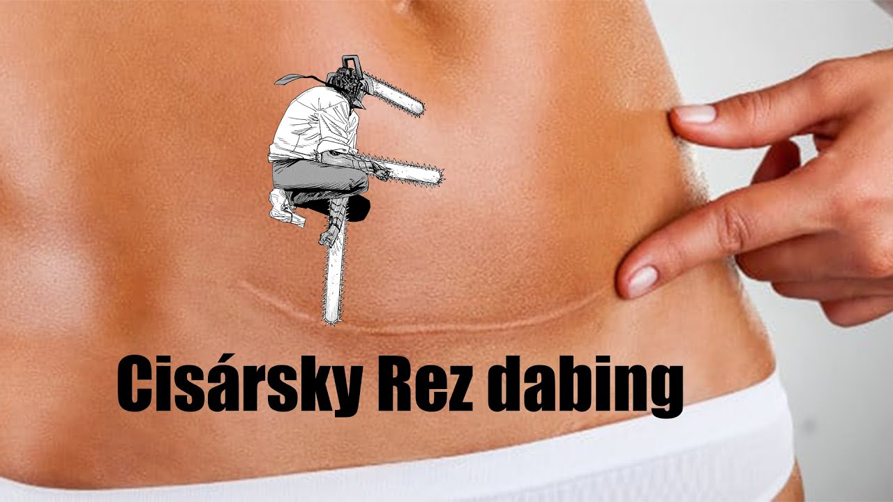 cisarsky rez