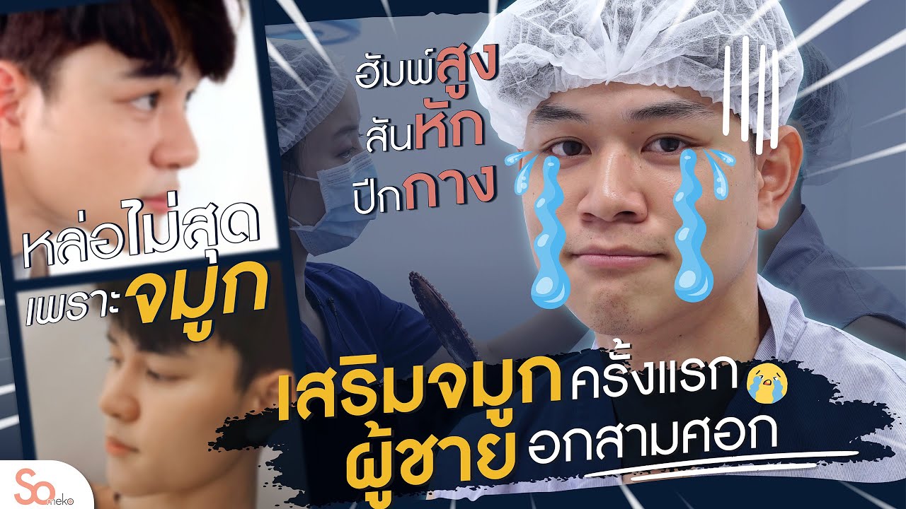 รีวิวเสริมจมูกครั้งแรกกับผู้ชายอกสามศอก งานนี้หมอมิว Someko จัดให้หล่อเลย