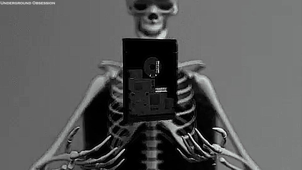 Bones - 