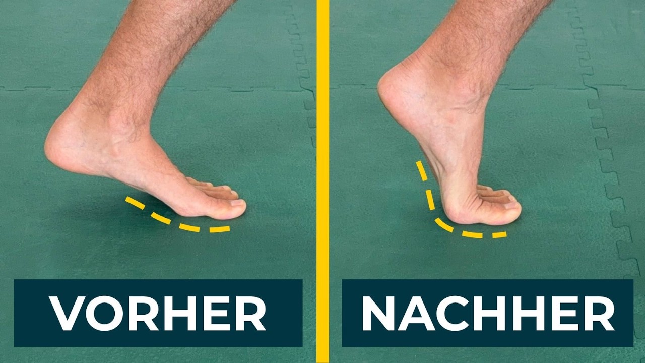 Hallux limitus & rigidus: Die besten Übungen