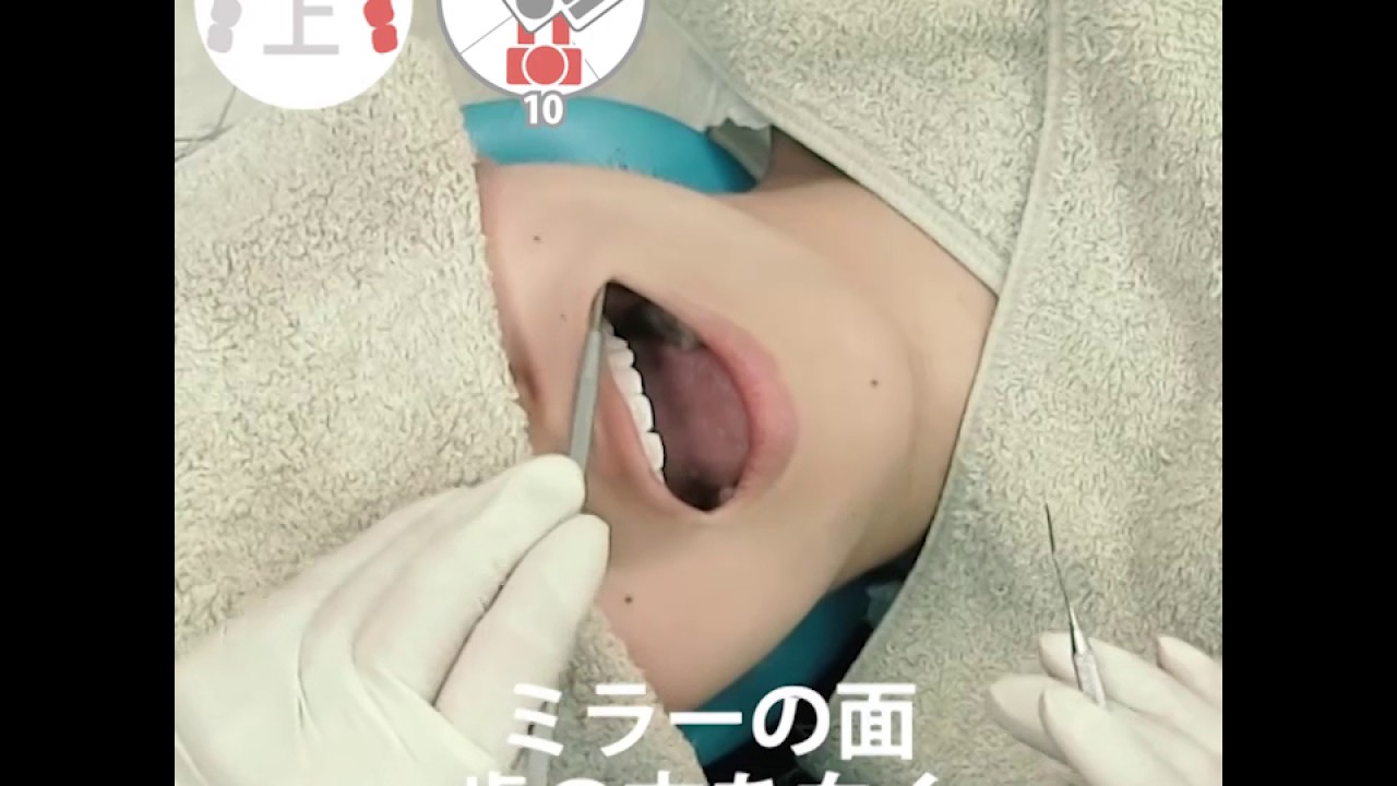 基本検査ポジション・レスト 07.左上4-7 実践編