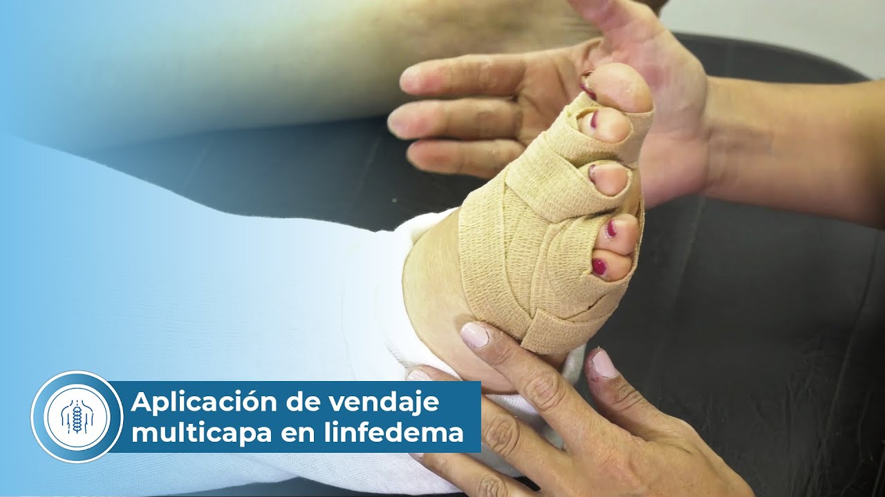 Aplicación de vendaje multicapa en linfedema