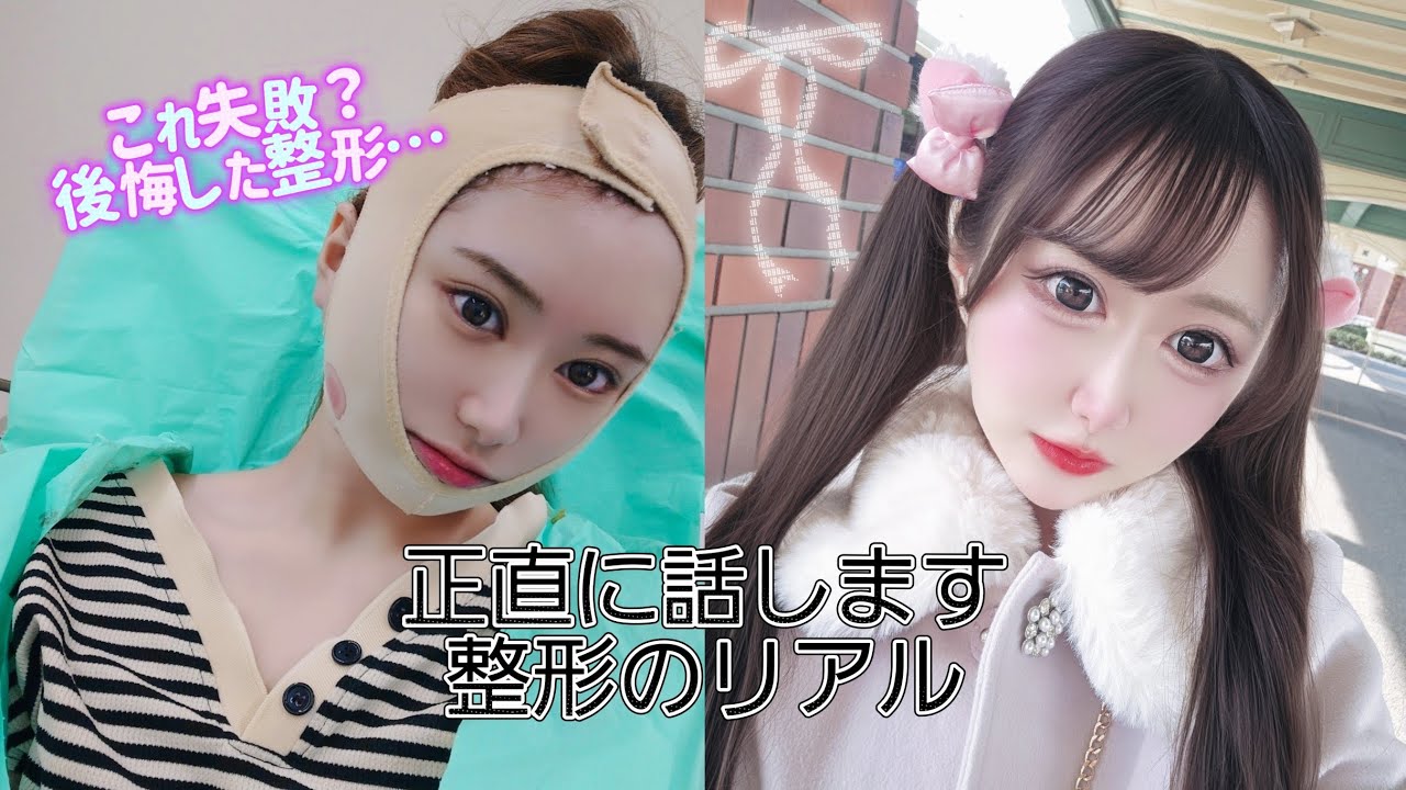 【整形】やって良かった整形と後悔してる整形、正直に話します。